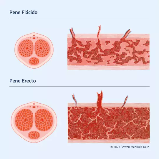 Infografía de los cuerpos cavernosos del pene